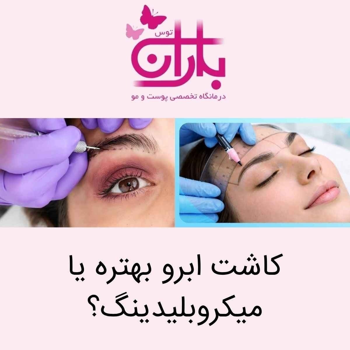 کاشت ابرو بهتره یا میکروبلیدینگ؟